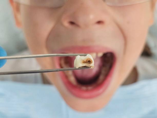 Best Walk-In Emergency Dentist in University Of Lifornia Santa Barbara, CA